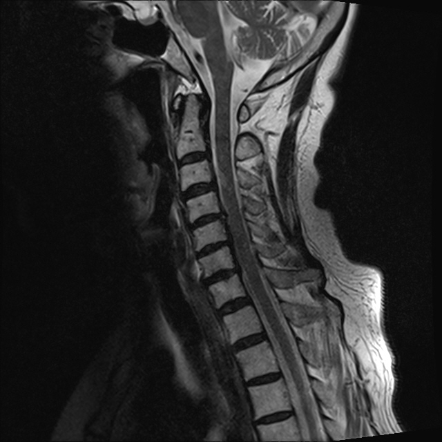 목 기존 검사 이미지