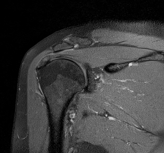 MRI 검사시간 [ 무릎, 어깨, 목, 허리 ] , 최대 50% 줄어듭니다.  전주신세계정형외과